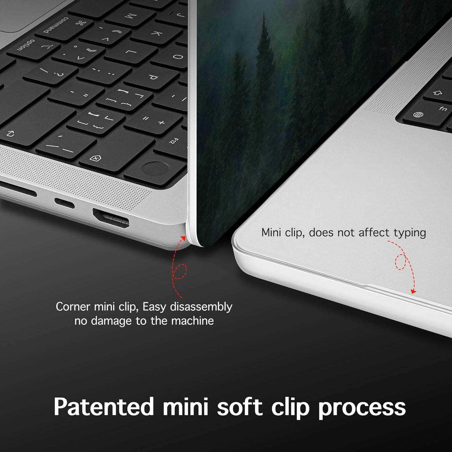 for MacBook Pro 16 inch Case 2021 2022 2023 2024 Release A3186 A3403 M4 A2991 M3 A2780 M2 A2485 M1 Pro/Max, Hard Shell Case with Screen Protector & Keyboard Cover, Forest